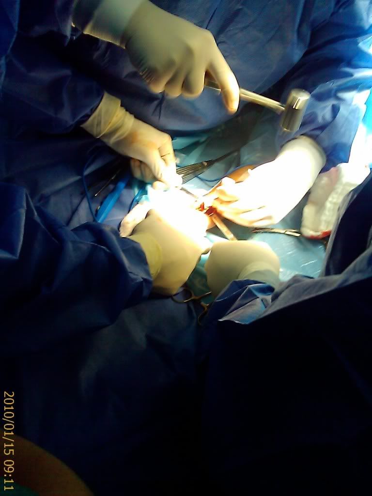 intervencion quirurgica